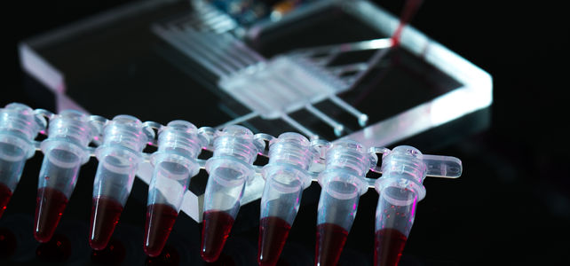 Lab-on-a-Chip – über die Labordiagnostik der Zukunft